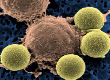 New Immunotherapy Childhood Blood Cancer Treatment Gains FDA Committee Approval