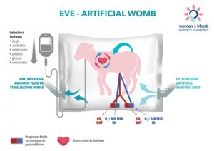 artificial Womb 