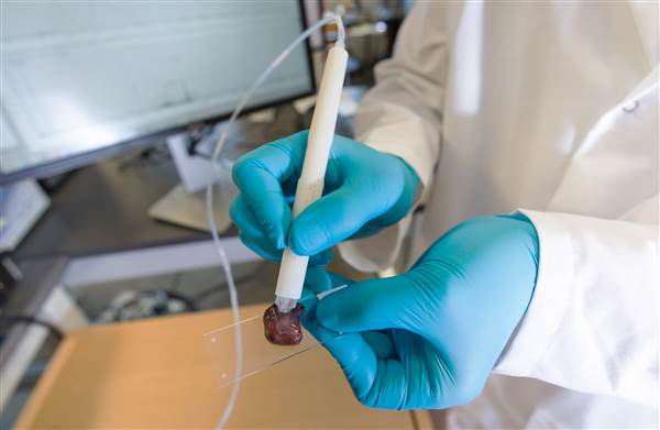 Handheld Cancer Pen Can Detect Tumors During Surgery in 10 Seconds